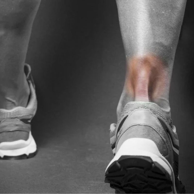 Padel calf and Achilles pain recovery guide